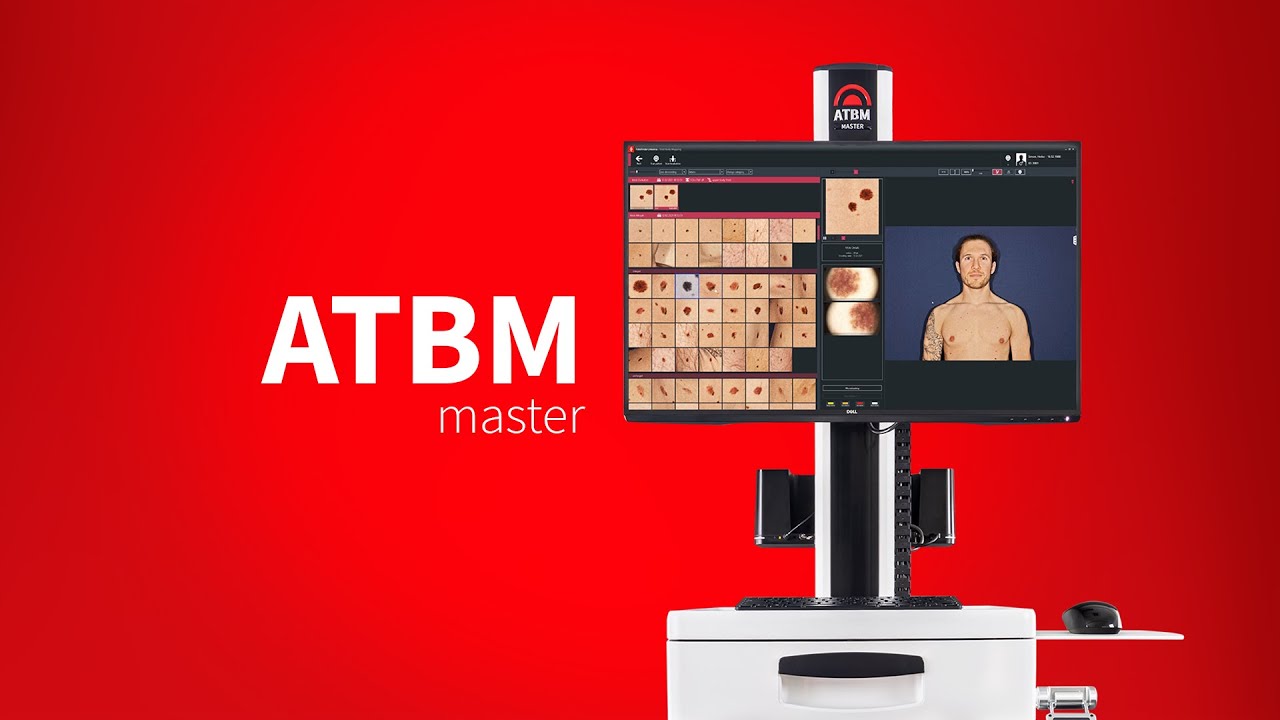 Digitální dermatoskop FotoFinder ATBM Master